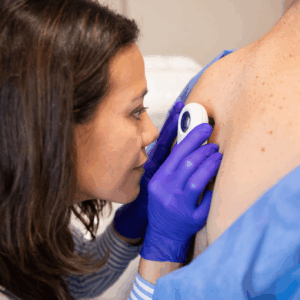 Dermatology ST3 Interview