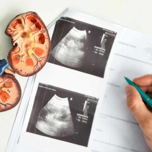 FRCS Urology Part 1