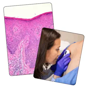 Dermatology Interview - Mock Only - 14th March 2026